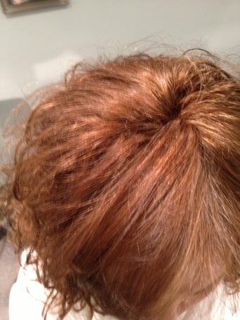 Hair Extensions For Thinning Hair